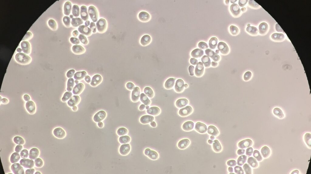 Saccharomyces_cerevisiae_100x_phase-contrast_microscopy (1)