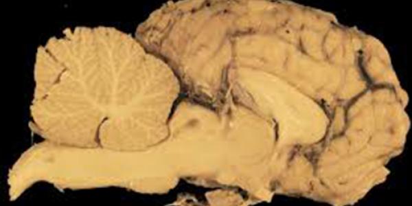 neuropatologia_2 neuropatologia_2
