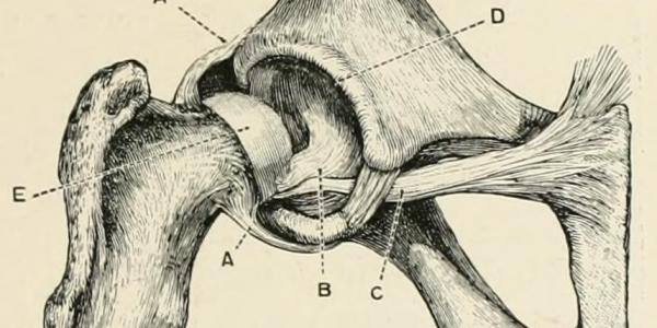 the_horse_its_treatment_in_health_and_disease_with_a_complete_guide_to_breeding_training_and_management_1906_14585649459