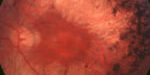 20160926_Ceron_ONCE 20160926_Ceron_ONCE