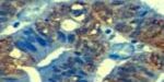 20161107_Esteller_PNAS 20161107_Esteller_PNAS
