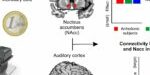 20161117_Cognicio_Anhedonia 20161117_Cognicio_Anhedonia