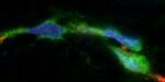 DERMIS_IF_ELAweb DERMIS_IF_ELAweb