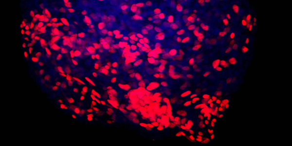 Hematopoietic-Stem-Cell-Biology-And-Leukemogenesis