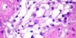 NO078 - P Garcia-Roves_Diabetes - Imatges