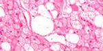 NO081 - IDIBGI_JCI - Imatge