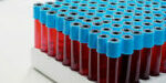 NO83 - Mussetti_Transplantation - Imatge NO83 - Mussetti_Transplantation - Imatge
