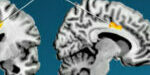 NP15 - E Camara_Disorders Moviment - Imatge NP15 - E Camara_Disorders Moviment - Imatge