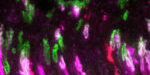 NP9 Ceguera_AMendez_CellDeath&Dis - Image (JPG) - A NP9 Ceguera_AMendez_CellDeath&Dis - Image (JPG) - A