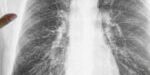 cancer_hereditary_GettyImages1213857828_Header-1024x575 (1)