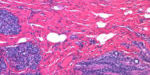 cancer_mama cancer_mama