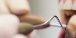 Dentist examining a female patient with tools