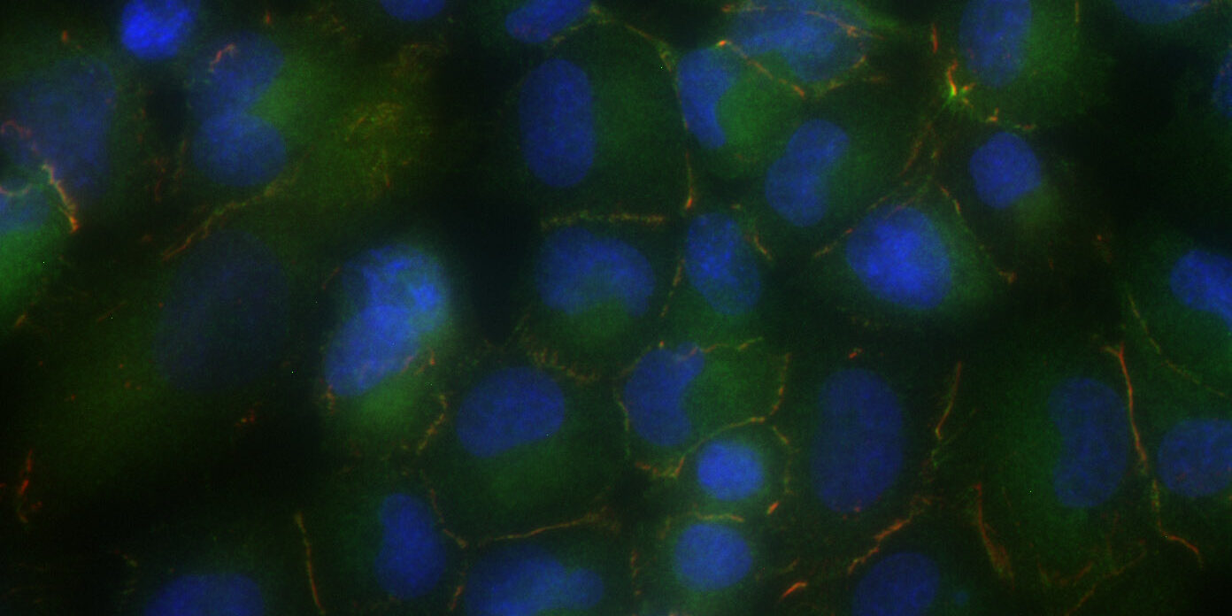 ImageJ=1.48t
unit=micron