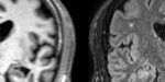 np8_epilepsia_ecamara_ejepilepsia_-_images1 np8_epilepsia_ecamara_ejepilepsia_-_images1