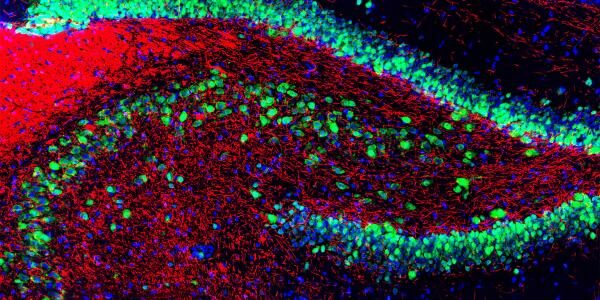 rat_hippocampus_stained_with_antibody_to_neun_green_myelin_basic_protein_red_and_dna_blue