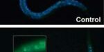 recurso-paper-Retinitis-2 recurso-paper-Retinitis-2