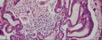 Pancreas-regeneration-pancreatic-progenitors-and-their-niche2