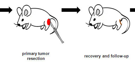 20160830_MtezTirado_Sarcoma