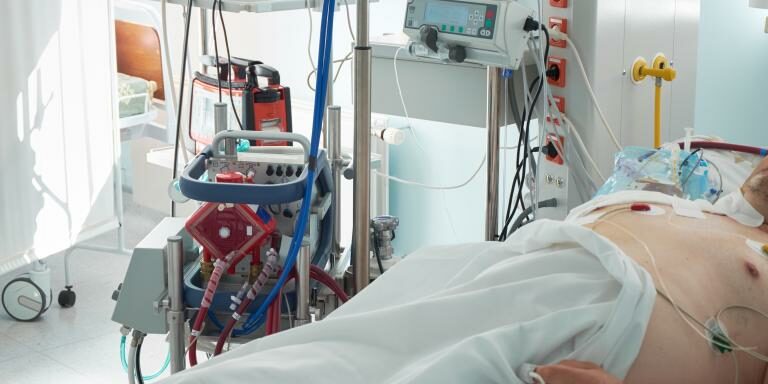 ECMO