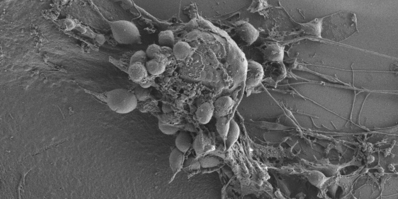 nuclear fragments in gossypol glioblastoma-treated cell (1)