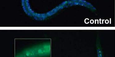 recurso-paper-Retinitis-2