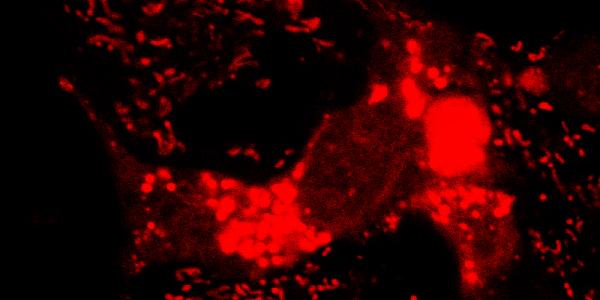 118-metabolismecancer-gthomas-def 118-metabolismecancer-gthomas-def